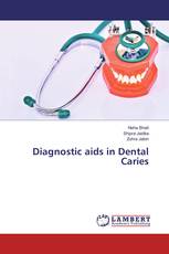 Diagnostic aids in Dental Caries