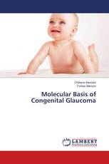 Molecular Basis of Congenital Glaucoma
