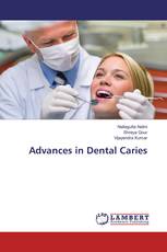 Advances in Dental Caries