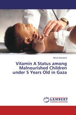 Vitamin A Status among Malnourished Children under 5 Years Old in Gaza