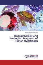 Histopathology and Serological Diagnosis of Human Hydatidosis