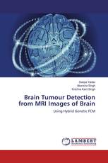 Brain Tumour Detection from MRI Images of Brain