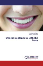 Dental Implants In Esthetic Zone