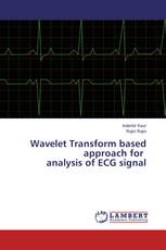 Wavelet Transform based approach for analysis of ECG signal