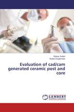 Evaluation of cad/cam generated ceramic post and core