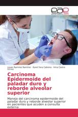 Carcinoma Epidermoide del paladar duro y reborde alveolar superior