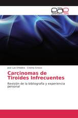 Carcinomas de Tiroides Infrecuentes