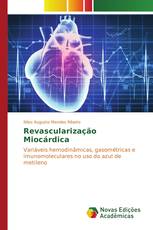 Revascularização Miocárdica