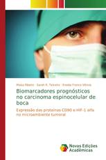 Biomarcadores prognósticos no carcinoma espinocelular de boca