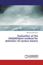 Evaluation of the DIAGNOdent method for detection of carious lesions