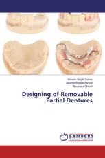 Designing of Removable Partial Dentures