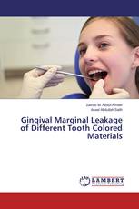 Gingival Marginal Leakage of Different Tooth Colored Materials