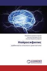 Нейросифилис