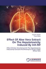 Effect Of Aloe Vera Extract On The Hepatotoxicity Induced By Inh-Rif