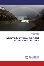Minimally invasive bonded esthetic restorations