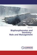 Bisphosphonates and Dentistry- Role and Management