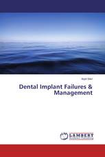 Dental Implant Failures & Management
