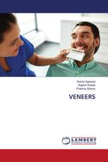 VENEERS