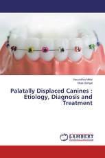 Palatally Displaced Canines : Etiology, Diagnosis and Treatment
