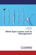 White Spot Lesions and its Management