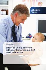 Effect of using different orthodontic forces on IL-2 level in humans