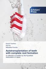 Autotransplantation of teeth with complete root formation