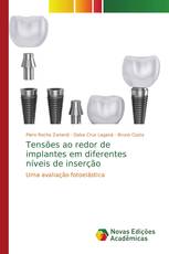 Tensões ao redor de implantes em diferentes níveis de inserção