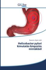Helicobacter pylori kimutatás biopsziás mintákból