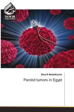 Parotid tumors in Egypt