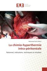 La chimio-hyperthermie intra-péritonéale