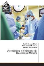 Osteoporosis in Cholelithiasis: Biochemical Markers