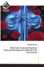 Minimally Invasive Nephron Sparing Managment of Renal Cell Carcinoma