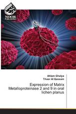 Expression of Matrix Metalloproteinase 2 and 9 in oral lichen planus