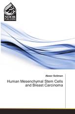 Human Mesenchymal Stem Cells and Breast Carcinoma
