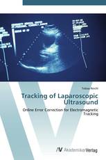 Tracking of Laparoscopic Ultrasound
