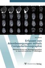 Erfassen von Atembewegungen mittels Computertomographie