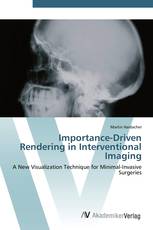 Importance-Driven Rendering in Interventional Imaging