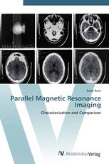 Parallel Magnetic Resonance Imaging
