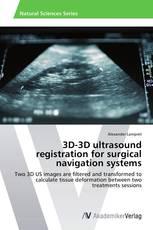 3D-3D ultrasound registration for surgical navigation systems