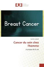 Cancer du sein chez l'homme