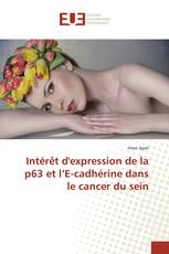 Intérêt d'expression de la p63 et l’E-cadhérine dans le cancer du sein