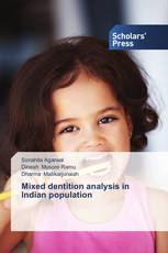 Mixed dentition analysis in Indian population