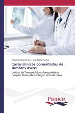 Casos clínicos comentados de tumores óseos