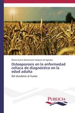 Osteoporosis en la enfermedad celíaca de diagnóstico en la edad adulta