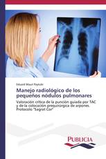 Manejo radiológico de los pequeños nódulos pulmonares