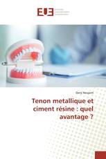 Tenon metallique et ciment résine : quel avantage ?