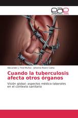 Cuando la tuberculosis afecta otros órganos