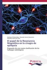 El papel de la Resonancia Magnética en la cirugía de epilepsia