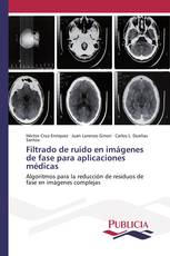 Filtrado de ruido en imágenes de fase para aplicaciones médicas