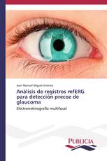 Análisis de registros mfERG para detección precoz de glaucoma